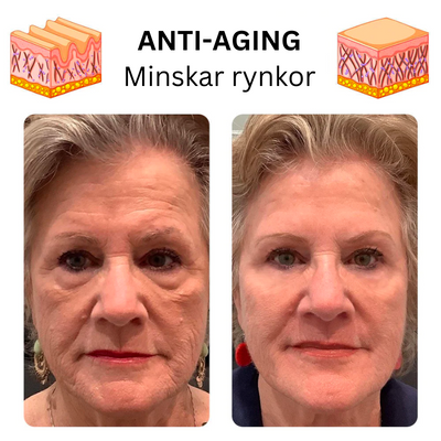 (1+1 Gratis) Serumist® | Advanced Collagen Boost Anti-Aging Serum