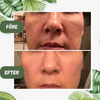 GreenPeel® | Grönt te djuprengörande mask stick