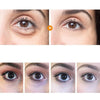 EyeBlends® | Se yngre, fräschare och mer livfulla ögon